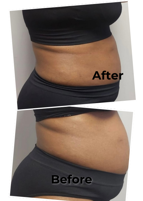 Lemon Bottle Large Body Area Treatment